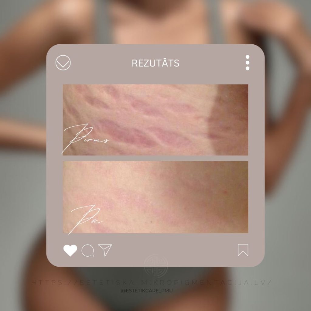 MEDICĪNISKĀ M. Instagram Post II - 13